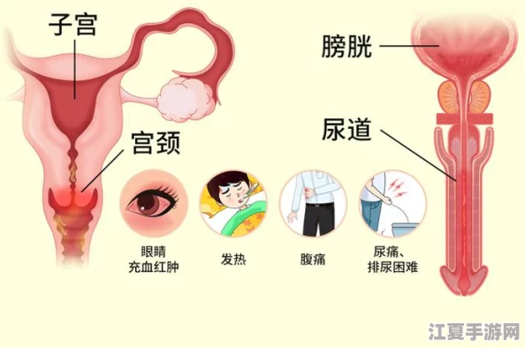 胡桃尿道口流出白色脓状物是什么？网友热议：可能是感染，建议及时就医以免耽误治疗！